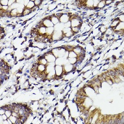 Prostaglandin G/H Synthase 2 / COX-2 (PTGS2) Antibody
