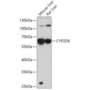 Western blot analysis of extracts of various cell lines using CYP2D6 Antibody (1/1000 dilution).