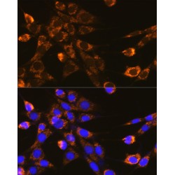 Integrin Beta 1 (ITGB1) Antibody