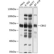 Western blot analysis of extracts of various cell lines using CBX2 Antibody (1/1000 dilution).