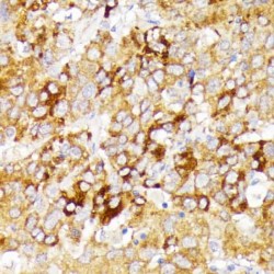 Galactosylceramidase (GALC) Antibody
