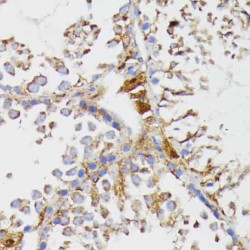 Galactosylceramidase (GALC) Antibody
