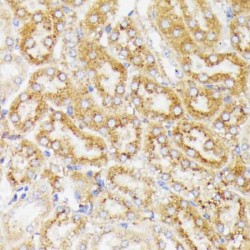 Galactosylceramidase (GALC) Antibody