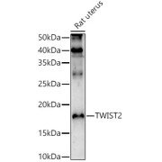 Western blot analysis of extracts of Rat uterus using TWIST2 Antibody (1/1000 dilution).