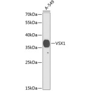 Western blot analysis of extracts of A-549 cells using VSX1 Antibody (1/1000 dilution).
