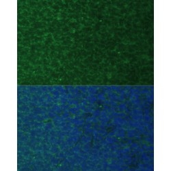 Phorbol-12-Myristate-13-Acetate-Induced Protein 1 (PMAIP1) Antibody