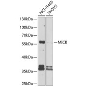 Western blot analysis of extracts of various cell lines using MICB Antibody (1/1000 dilution).