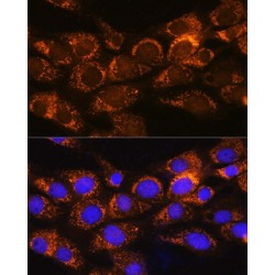 2-Oxoisovalerate Dehydrogenase Subunit Alpha, Mitochondrial (BCKDHA) Antibody