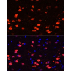 Calretinin (CALB2) Antibody