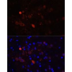 Calretinin (CALB2) Antibody