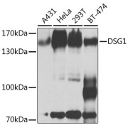 Western blot analysis of extracts of various cell lines using DSG1 Antibody (1/1000 dilution).