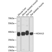Western blot analysis of extracts of various cell lines using HOXA13 Antibody (1/1000 dilution).