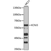 Western blot analysis of extracts of MCF7 cells using KCNJ3 Antibody (1/1000 dilution).
