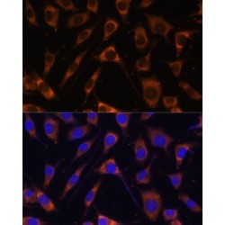 Laminin, Beta 1 (LAMB1) Antibody
