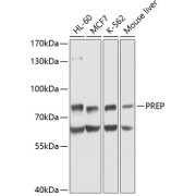 Western blot analysis of extracts of various cell lines using PREP Antibody (1/1000 dilution).