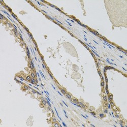 Inactive Tyrosine-Protein Kinase 7 (PTK7) Antibody