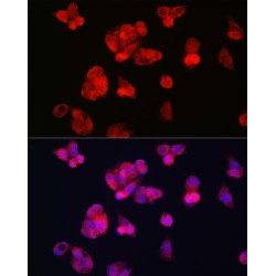 Transferrin Receptor Protein 2 (TFR2) Antibody