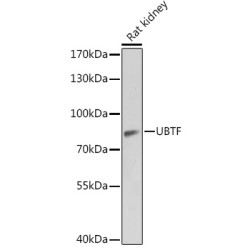 Nucleolar Transcription Factor 1 (UBTF) Antibody