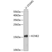 Western blot analysis of extracts of U-251MG cells using KCNE2 Antibody (1/1000 dilution).