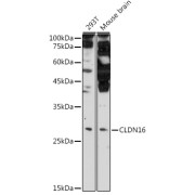 Western blot analysis of extracts of various cell lines using CLDN16 Antibody (1/500 dilution).