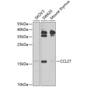 Western blot analysis of extracts of various cell lines using CCL27 Antibody (1/1000 dilution).