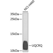 Western blot analysis of extracts of H460 cells using UQCRQ Antibody (1/1000 dilution).