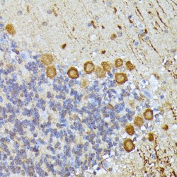 Elongator Acetyltransferase Complex Subunit 3 (ELP3) Antibody