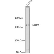Western blot analysis of extracts of SKOV3 cells using NLRP5 Antibody (1/1000 dilution).