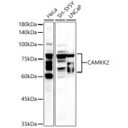 Western blot analysis of extracts of various cell lines using CAMKK2 Antibody (1/500 dilution).