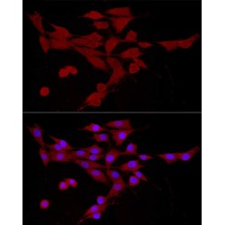 Calcium/calmodulin-Dependent Protein Kinase Kinase 2 (CAMKK2) Antibody