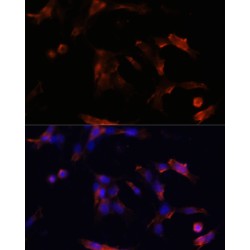 Aquaporin 5 (AQP5) Antibody