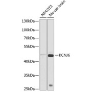 Western blot analysis of extracts of various cell lines using KCNJ6 Antibody (1/1000 dilution).
