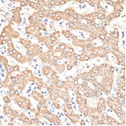 Immunohistochemistry of paraffin-embedded Human liver using KIR3DS1 Antibody (1/100 dilution, 40x lens).