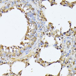 Proteasome Subunit Beta Type 3 (PSMB3) Antibody