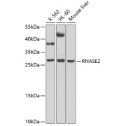 abx135869