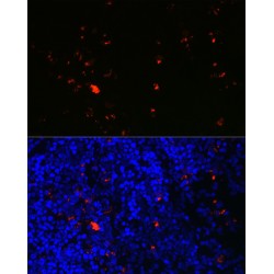 Eosinophil Derived Neurotoxin (RNASE2) Antibody