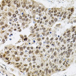 BRG1-Associated Factor 60A (BAF60a) Antibody