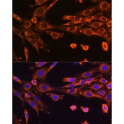 Suv3 Like RNA Helicase (SUPV3L1) Antibody