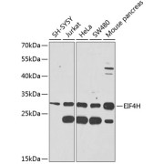 abx135873