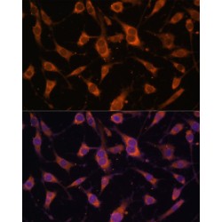 Fibulin 5 (FBLN5) Antibody