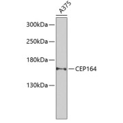abx135884