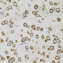 Centrosomal Protein 164 kDa (CEP164) Antibody