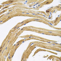 Centrosomal Protein 164 kDa (CEP164) Antibody