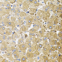 Centrosomal Protein 164 kDa (CEP164) Antibody