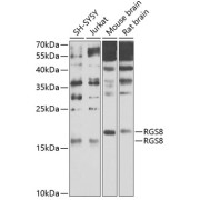Western blot analysis of extracts of various cell lines using RGS8 Antibody (1/1000 dilution).