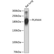 Western blot analysis of extracts of rat lung using PLXNA4 Antibody (1/1000 dilution).
