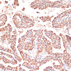 FERM Domain-Containing Protein 6 (FRMD6) Antibody