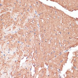 FERM Domain-Containing Protein 6 (FRMD6) Antibody