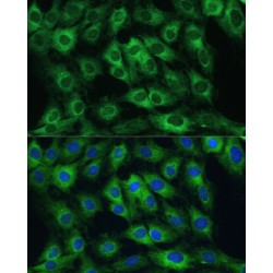 FERM Domain-Containing Protein 6 (FRMD6) Antibody