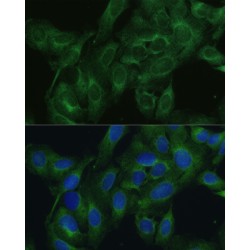 FERM Domain-Containing Protein 6 (FRMD6) Antibody